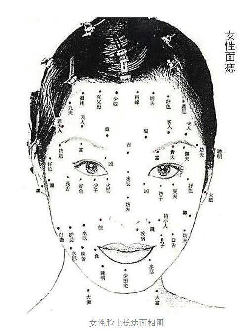 痣长在这3个位置增加癌变风险吗痣是皮肤上的良性肿瘤，通常不会癌变。然而，某些特定位置的痣可能会增加癌变的风险，尤其是以下三个位置